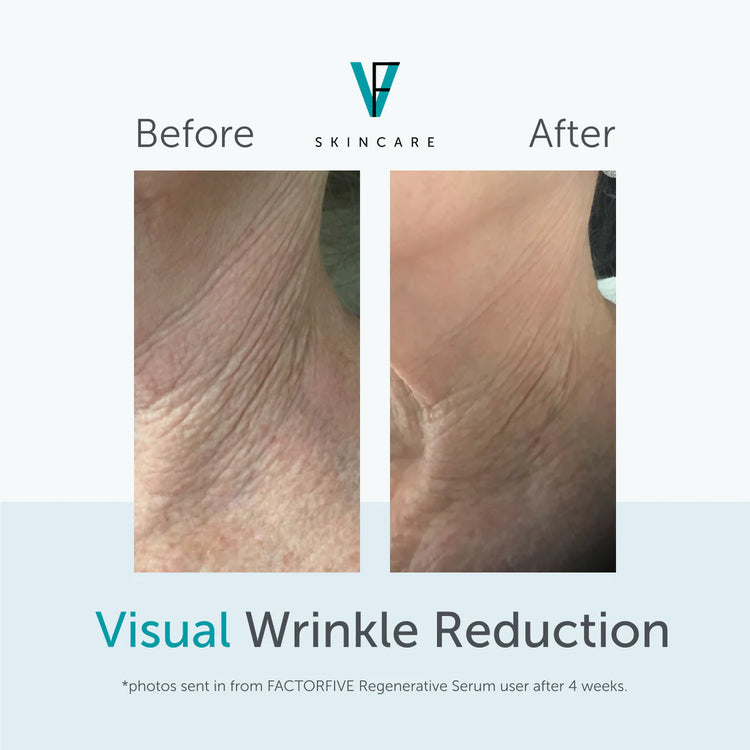 Regenerative Serum FactorFive