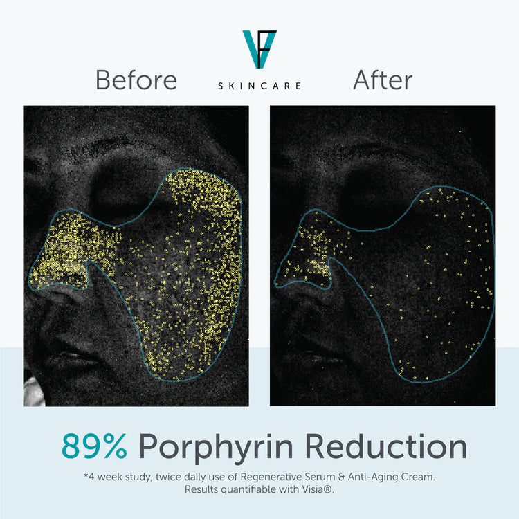 Regenerative Serum FactorFive